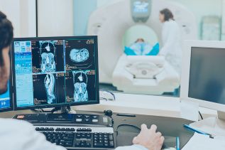 Understanding MRI Whole Spine Screening