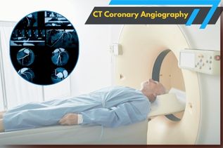 What Is CT Coronary Angiography (CTCA) Scan