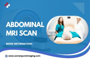 Abdominal MRI Scan