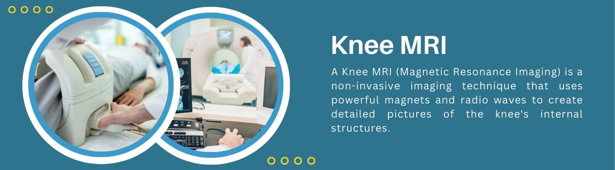 Understanding Knee MRI Scans: Procedure, Benefits, and Diagnosis